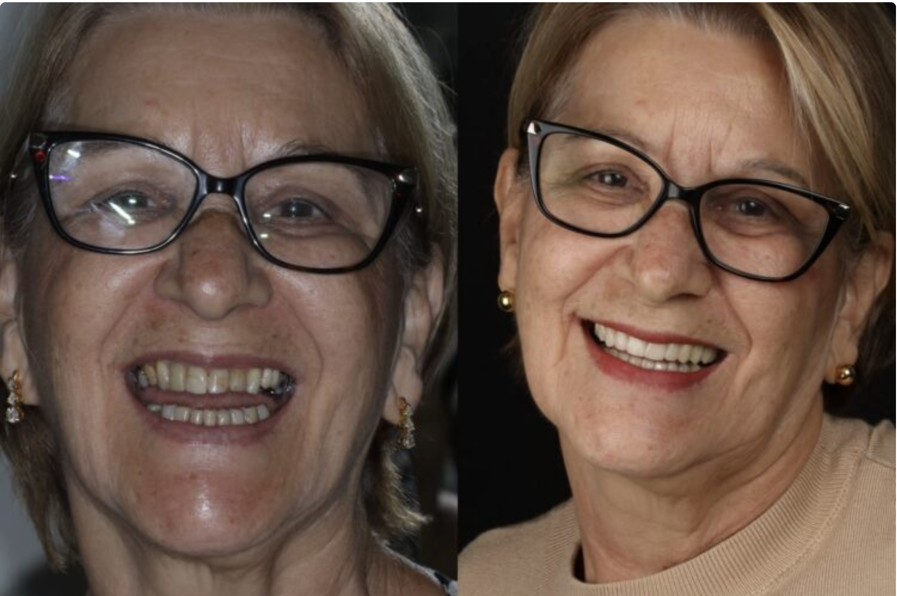 Quando o sorriso muda, a vida muda junto.